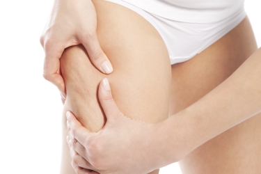 Come combattere la cellulite